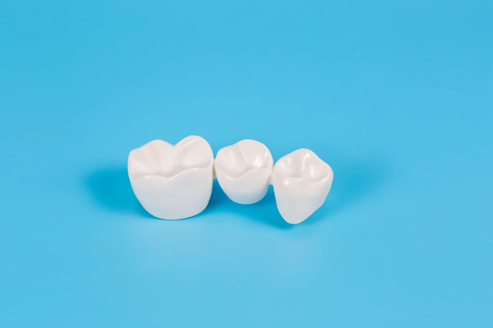 Clearwater Fl Dental Crowns