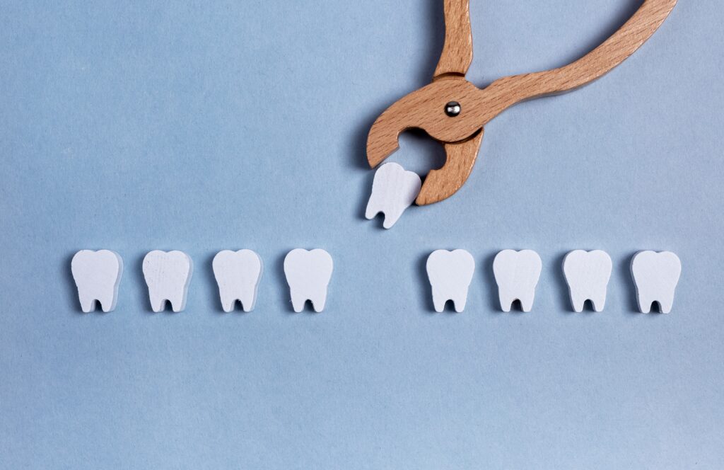 Risks of Delaying Wisdom Teeth Extraction