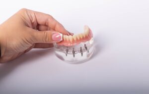 Hand holding a permanent denture model.