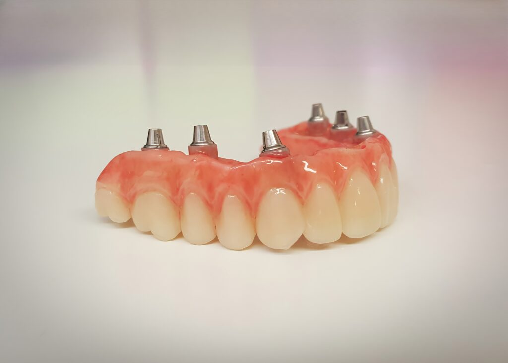 Questions For Your Dentist About New Dentures