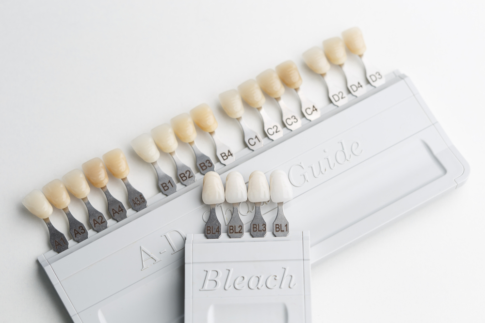 Porcelain Veneers vs. Composite Veneers: Which Is Right for You?